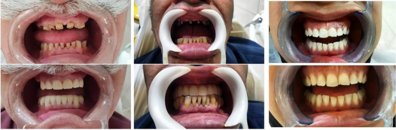 دندانپزشک زیبایی خوب در مشهد 